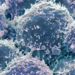 Bridging the Gap: How New Validation of IMACS Guidelines Could Revolutionize Cancer Screening in Dermatomyositis Patients