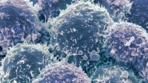 Bridging the Gap: How New Validation of IMACS Guidelines Could Revolutionize Cancer Screening in Dermatomyositis Patients