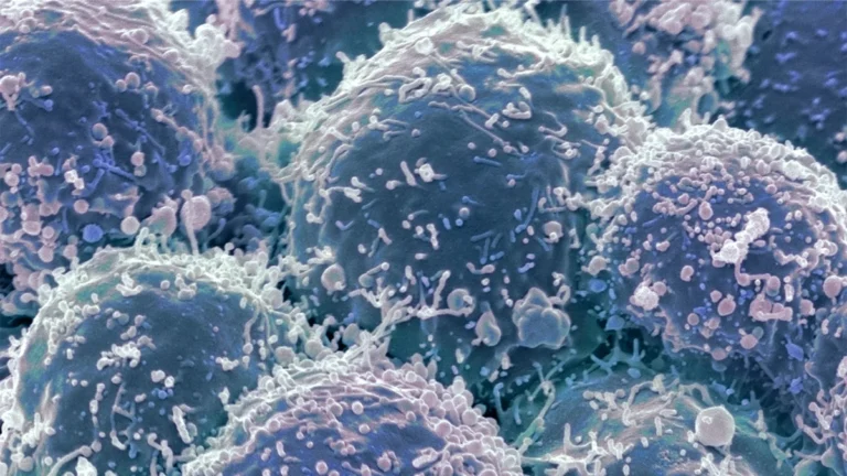 Bridging the Gap: How New Validation of IMACS Guidelines Could Revolutionize Cancer Screening in Dermatomyositis Patients