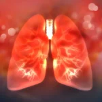 Celea Therapeutics Secures $180M to Advance Next-Generation IPF Treatment