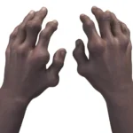 Crystalys Therapeutics Secures $130 Million to Propel Gout Drug Dotinurad Toward Market Entry