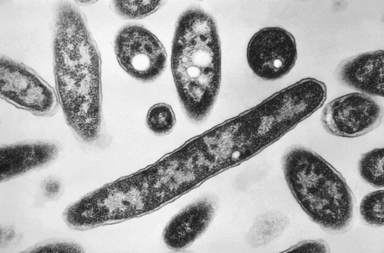 Escalating Health Crisis: Second Fatality Reported in Upper East Side Legionnaires’ Outbreak