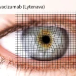 FDA Approves First Ophthalmic Bevacizumab for Wet AMD: A Milestone Two Decades in the Making