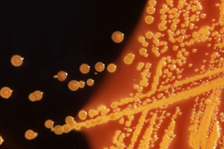 Food Safety Crisis: The Persistent Challenge of Contamination in America’s Fast-Food Supply Chain