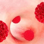 Immune Suppression and HPV-Related Malignancy: A Deep Dive into Elevated Cancer Risks
