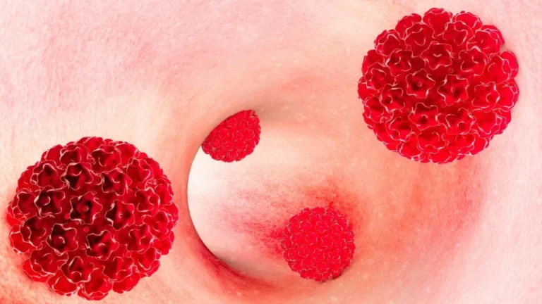 Immune Suppression and HPV-Related Malignancy: A Deep Dive into Elevated Cancer Risks