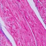Medtronic Bets on CoreMap: A Strategic Pivot to Precision in Atrial Fibrillation Treatment
