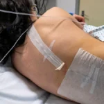 New Evidence Reassures Expectant Parents: Epidurals Linked to No Increased Risk of Neonatal Neurological Harm