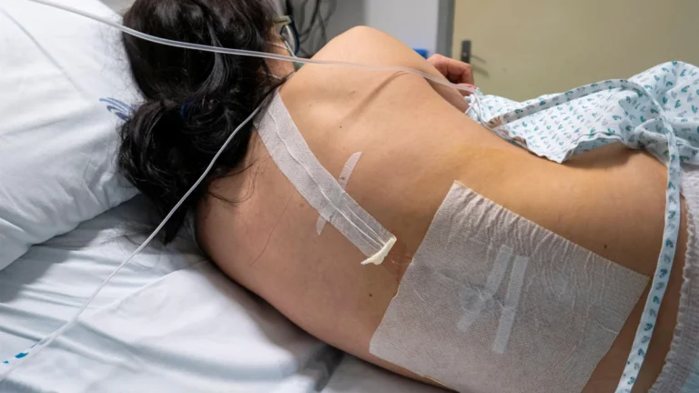 New Evidence Reassures Expectant Parents: Epidurals Linked to No Increased Risk of Neonatal Neurological Harm