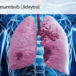 New Hope for Advanced Lung Cancer: FDA Approves Zidesamtinib for Pre-Treated ROS1-Positive NSCLC