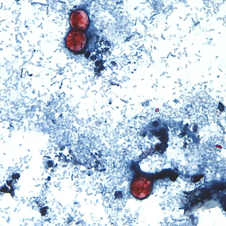 Public Health in Peril: The Mystery Behind the Historic Cyclospora Outbreak