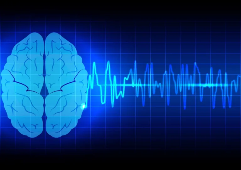 Redefining Vigilance: Why ‘Microsleeps’ Are Changing the Standard for Narcolepsy Treatment