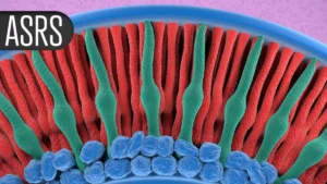 Retinal Nerve Fiber Thickening Linked to Geographic Atrophy Treatments: A Clinical Conundrum