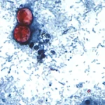 Rising Threat: Understanding the Nationwide Cyclospora Outbreak and Protecting Your Kitchen