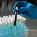 Tempus AI Set to Acquire Personalis in Strategic Push for Cancer Diagnostics Dominance