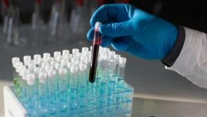 Tempus AI Set to Acquire Personalis in Strategic Push for Cancer Diagnostics Dominance