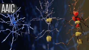 The Accelerated Mind: How Metabolic Syndrome Drives Premature Brain Aging