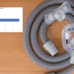 The Future of Sleep Therapy: Insights into CPAP Interface Innovation, Patient Compliance, and Clinical Practice