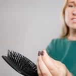 The Hidden Cost of Metabolic Transformation: Examining the Link Between GLP-1 Agonists and Hair Loss