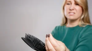The Hidden Cost of Metabolic Transformation: Examining the Link Between GLP-1 Agonists and Hair Loss