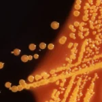 The High Stakes of Fast Food Safety: A Legacy of Outbreaks and Regulatory Change