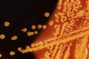 The High Stakes of Fast Food Safety: A Legacy of Outbreaks and Regulatory Change