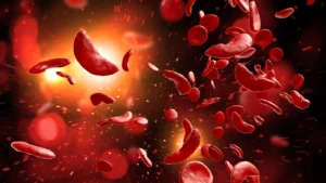 The Persistent Challenge of Sickle Cell Disease: Agios Pharmaceuticals Abandons Tebapivat Amid Industry-Wide Hurdles