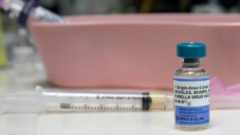 The Resurgence of a Preventable Crisis: U.S. Measles Outbreaks Reveal Severe Clinical Complications