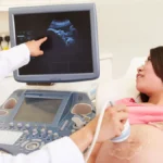 A Miracle of Modern Obstetrics: Navigating the Rarity of Fetus-in-Fetu