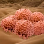 A New Era in Oncology: Replimune Secures FDA Approval for Tudriqev, Challenging the Status Quo in Advanced Melanoma