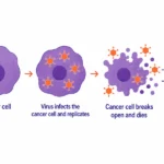 A New Frontier in Oncology: FDA Approves Tudriqev for Advanced Melanoma
