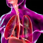 A New Horizon in Oncology: FDA Approves Zanidatamab for HER2-Positive Gastroesophageal Cancer