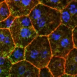 A Potential Breakthrough in Vision Loss: How Cholesterol Metabolism May Be the Key to Stopping Macular Degeneration