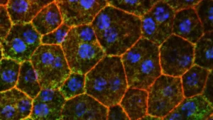 A Potential Breakthrough in Vision Loss: How Cholesterol Metabolism May Be the Key to Stopping Macular Degeneration