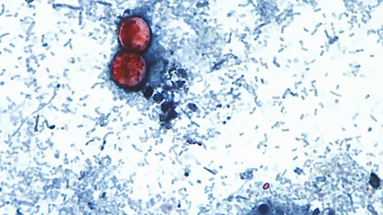 A Rare Tragedy: Michigan Reports First U.S. Deaths Linked to Cyclospora Outbreak