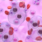 Advancements in Hematopoietic Cell Transplantation: A New Era for Relapsed or Refractory Hodgkin Lymphoma