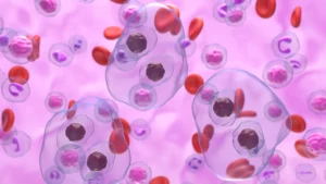 Advancements in Hematopoietic Cell Transplantation: A New Era for Relapsed or Refractory Hodgkin Lymphoma