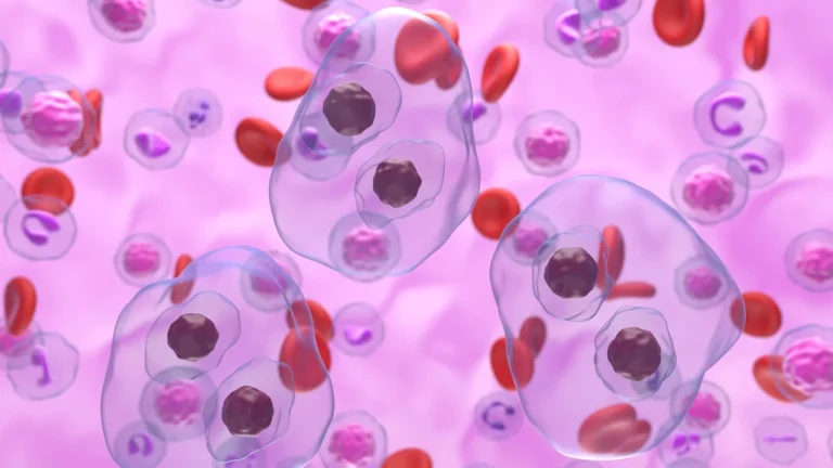 Advancements in Hematopoietic Cell Transplantation: A New Era for Relapsed or Refractory Hodgkin Lymphoma