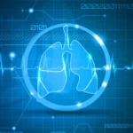 Advancing Pulmonary Diagnostics: Invenio Imaging Concludes Landmark ON-SITE Clinical Trial