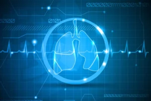 Advancing Pulmonary Diagnostics: Invenio Imaging Concludes Landmark ON-SITE Clinical Trial