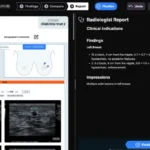 AI-Powered Precision: DeepHealth Secures FDA Clearance for Breakthrough Breast Ultrasound Diagnostic Tool
