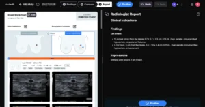 AI-Powered Precision: DeepHealth Secures FDA Clearance for Breakthrough Breast Ultrasound Diagnostic Tool