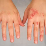 Attovia Therapeutics Secures $289 Million IPO to Revolutionize Biologic Treatment of Immune-Mediated Diseases
