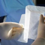 BD Reaches Clinical Milestone: Advancing Tissue Regeneration in Hernia Prevention