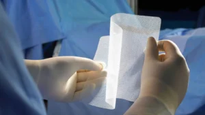 BD Reaches Clinical Milestone: Advancing Tissue Regeneration in Hernia Prevention