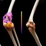 Beyond Cancer: Could CAR T-Cell Therapy Rewrite the Future of Autoimmune Treatment?