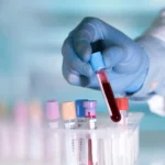 Beyond Cholesterol: A New Frontier in Predicting Cardiovascular Risk