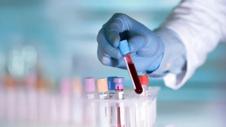 Beyond Cholesterol: A New Frontier in Predicting Cardiovascular Risk