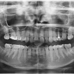 Beyond the Brush: Redefining Preventive Dentistry Through Digital Precision