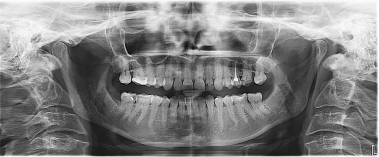 Beyond the Brush: Redefining Preventive Dentistry Through Digital Precision